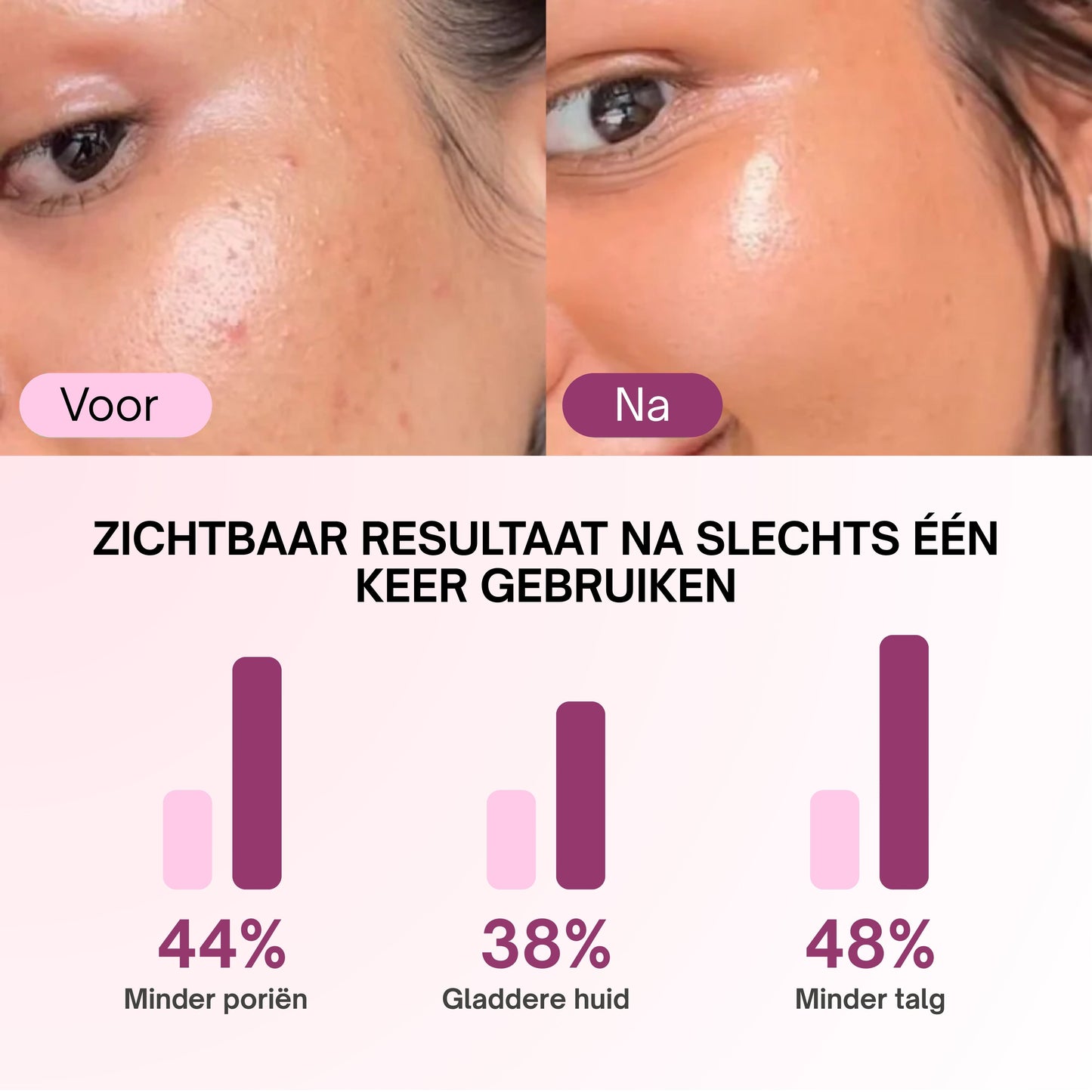 Zero Pore Pads – Calanera
