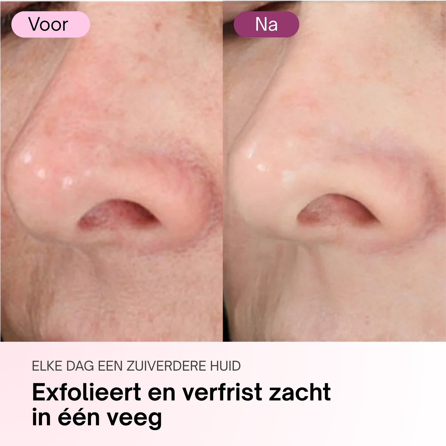 Zero Pore Pads – Calanera