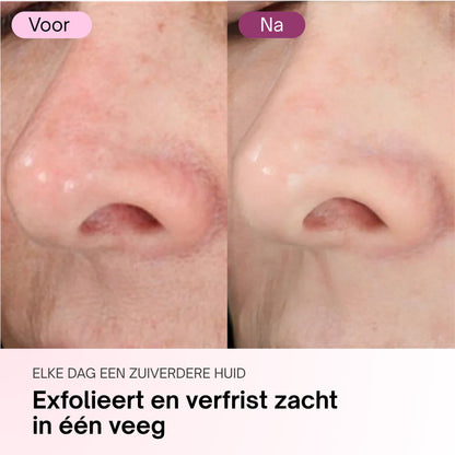Zero Pore Pads – Calanera