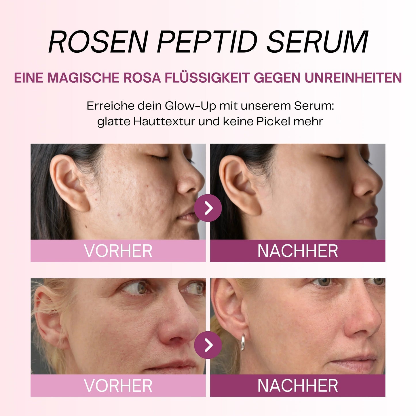 Peptid-Serum mit PDRN – Calanera