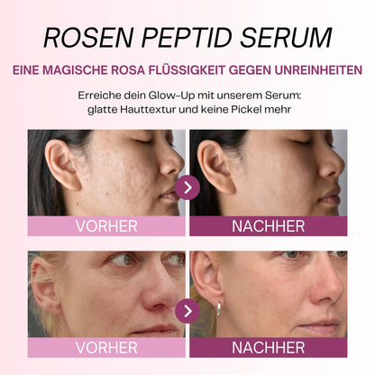 Peptid-Serum mit PDRN – Calanera