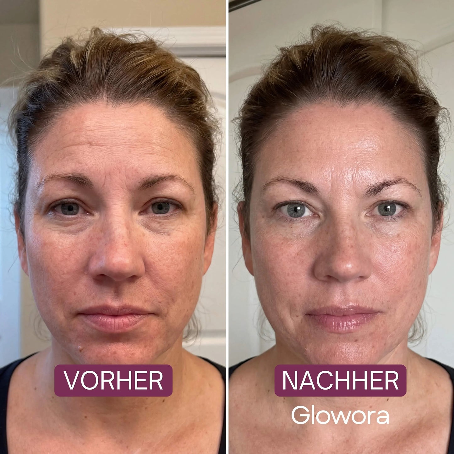 Anti-Aging-Set – Calanera
